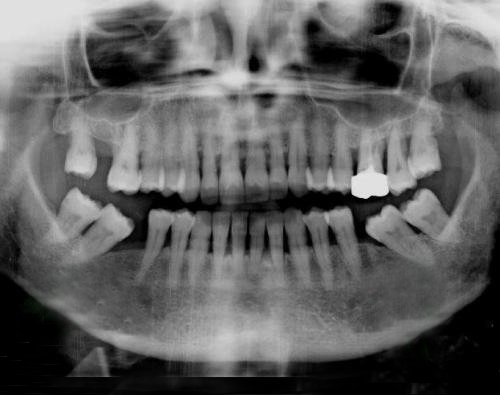 Orthodontie Paris 15 : Radiographie