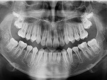 Radiographie Cabinet d'Orthodontie