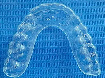 Gouttière Dentaire Orthodontie Enfant